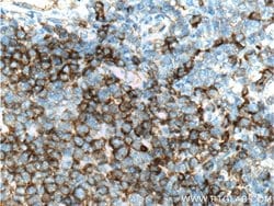 CD22 Mouse anti-Human, Clone: 7A2F1, Proteintech:Antibodies:Primary Antibodies