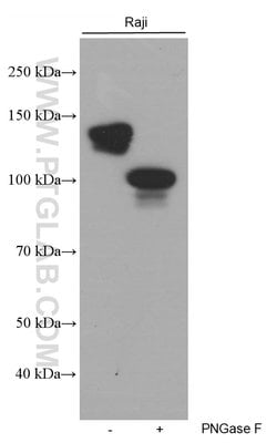 CD22 Mouse anti-Human, Clone: 7A2F1, Proteintech:Antibodies:Primary Antibodies