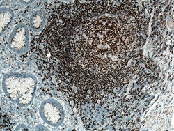 CD22 Mouse anti-Human, Clone: 7A2F1, Proteintech:Antibodies:Primary Antibodies