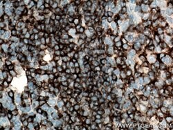 CD22 Mouse anti-Human, Clone: 7A2F1, Proteintech:Antibodies:Primary Antibodies