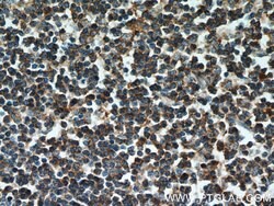 CD22 Mouse anti-Human, Clone: 7A2F1, Proteintech:Antibodies:Primary Antibodies
