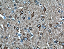 SULT4A1 Mouse anti-Human, Mouse, Clone: 1B9F6, Proteintech 20 &mu;L; Unconjugated:Antibodies,