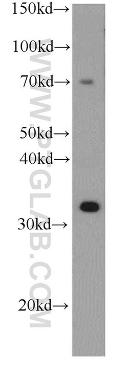 SULT4A1 Mouse anti-Human, Mouse, Clone: 1B9F6, Proteintech 20 &mu;L; Unconjugated:Antibodies,