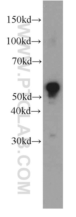 MAOB Mouse anti-Human, Clone: 2B12F3, Proteintech 150 &mu;L; Unconjugated:Antibodies,