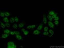 TFIP11 Mouse anti-Human, Clone: 1A1C8, Proteintech 150 &mu;L; Unconjugated:Antibodies,