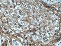 TFIP11 Mouse anti-Human, Clone: 1A1C8, Proteintech 150 &mu;L; Unconjugated:Antibodies,