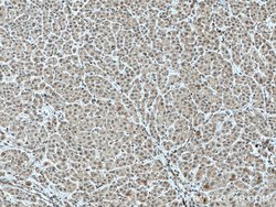 TFIP11 Mouse anti-Human, Clone: 1A1C8, Proteintech 150 &mu;L; Unconjugated:Antibodies,