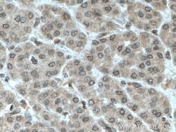 TFIP11 Mouse anti-Human, Clone: 1A1C8, Proteintech 150 &mu;L; Unconjugated:Antibodies,