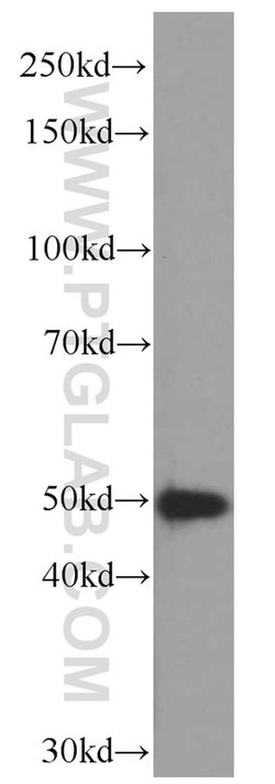 CSK Mouse anti-Human, Mouse, Clone: 3B12C5, Proteintech 150 &mu;L; Unconjugated:Antibodies,