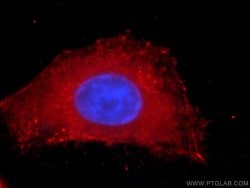PDH E1 alpha Mouse anti-Human, Clone: 2B3C10, Proteintech:Antibodies:Primary