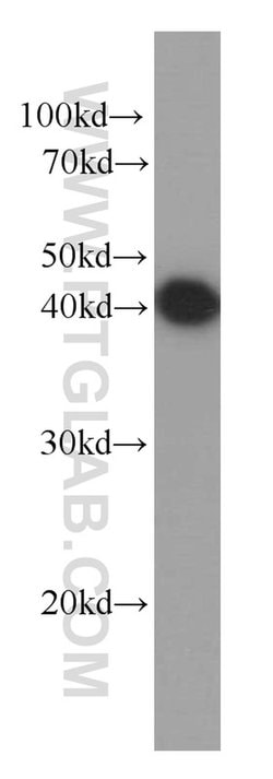 PDH E1 alpha Mouse anti-Human, Clone: 2B3C10, Proteintech:Antibodies:Primary