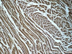 PDH E1 alpha Mouse anti-Human, Clone: 2B3C10, Proteintech:Antibodies:Primary