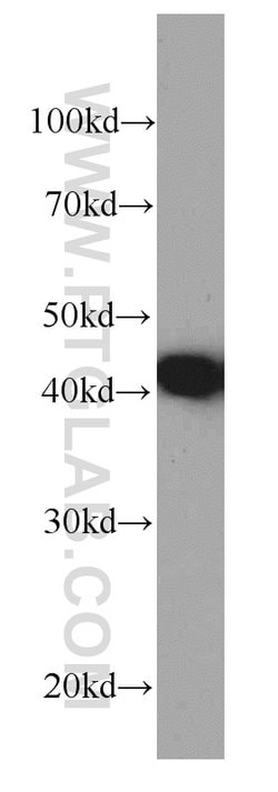 PDH E1 alpha Mouse anti-Human, Clone: 2B3C10, Proteintech:Antibodies:Primary