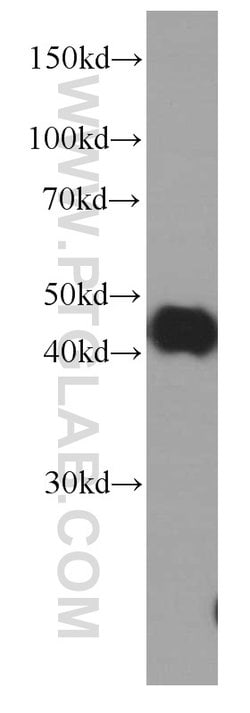 PDH E1 alpha Mouse anti-Human, Clone: 2B3C10, Proteintech:Antibodies:Primary