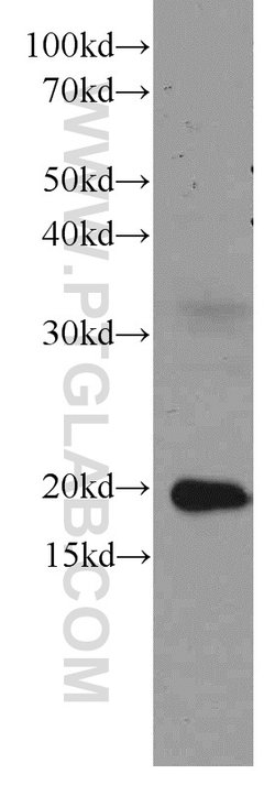Rac1 Mouse anti-Human, Mouse, Rat, Clone: 4A4B11, Proteintech:Antibodies:Primary