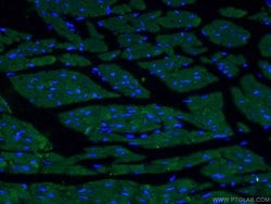 ACTC1 Mouse anti-Human, Mouse, Porcine, Rat, Clone: 1F2B9, Proteintech
