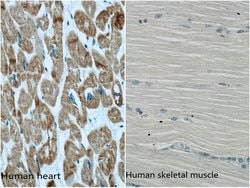 ACTC1 Mouse anti-Human, Mouse, Porcine, Rat, Clone: 1F2B9, Proteintech