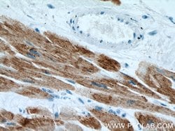 ACTC1 Mouse anti-Human, Mouse, Porcine, Rat, Clone: 1F2B9, Proteintech