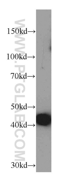 ACTC1 Mouse anti-Human, Mouse, Porcine, Rat, Clone: 1F2B9, Proteintech