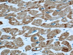 ACTC1 Mouse anti-Human, Mouse, Porcine, Rat, Clone: 1F2B9, Proteintech