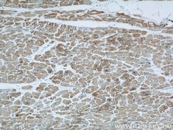 ACTC1 Mouse anti-Human, Mouse, Porcine, Rat, Clone: 1F2B9, Proteintech