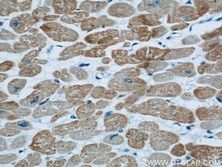 ACTC1 Mouse anti-Human, Mouse, Porcine, Rat, Clone: 1F2B9, Proteintech