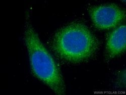 Alpha-2-macroglobulin Mouse anti-Human, Clone: 4B11F7, Proteintech 150