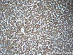 Alpha-2-macroglobulin Mouse anti-Human, Clone: 4B11F7, Proteintech 150