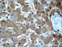 Alpha-2-macroglobulin Mouse anti-Human, Clone: 4B11F7, Proteintech 150