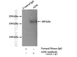 Alpha-2-macroglobulin Mouse anti-Human, Clone: 4B11F7, Proteintech 150