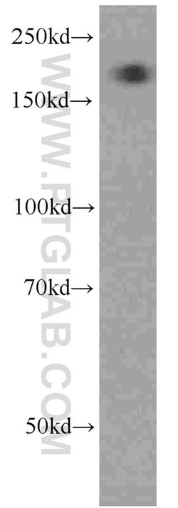 Alpha-2-macroglobulin Mouse anti-Human, Clone: 4B11F7, Proteintech 150
