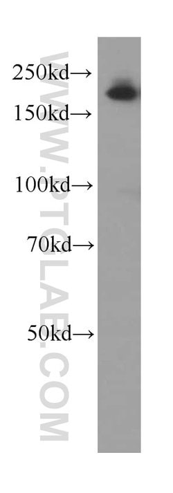 Alpha-2-macroglobulin Mouse anti-Human, Clone: 4B11F7, Proteintech 150