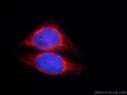AK2 Mouse anti-Human, Clone: 3H2C10, Proteintech 150 &mu;L | Buy Online | Proteintech Group Inc | Fisher Scientific