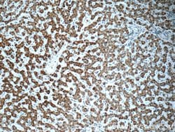 AK2 Mouse anti-Human, Clone: 3H2C10, Proteintech 150 &mu;L | Buy Online | Proteintech Group Inc | Fisher Scientific
