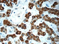 AK2 Mouse anti-Human, Clone: 3H2C10, Proteintech 150 &mu;L | Buy Online | Proteintech Group Inc | Fisher Scientific