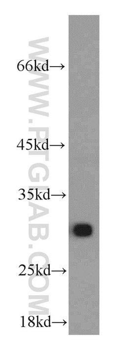 AK2 Mouse anti-Human, Clone: 3H2C10, Proteintech 150 &mu;L | Buy Online | Proteintech Group Inc | Fisher Scientific