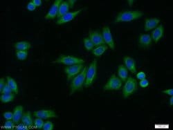 AK2 Mouse anti-Human, Clone: 3H2C10, Proteintech 150 &mu;L | Buy Online | Proteintech Group Inc | Fisher Scientific