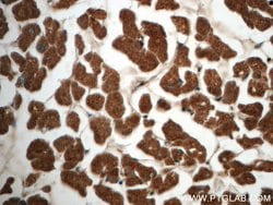 AK2 Mouse anti-Human, Clone: 3H2C10, Proteintech 150 &mu;L | Buy Online | Proteintech Group Inc | Fisher Scientific