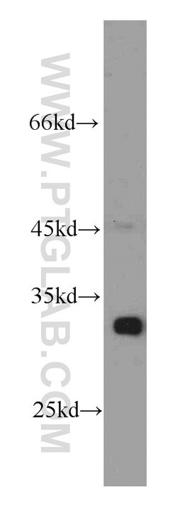 AK2 Mouse anti-Human, Clone: 3H2C10, Proteintech 150 &mu;L | Buy Online | Proteintech Group Inc | Fisher Scientific