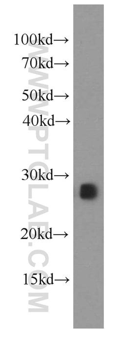 IL-17D Mouse anti-Human, Clone: 1D7H4, Proteintech:Antibodies:Primary Antibodies
