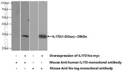IL-17D Mouse anti-Human, Clone: 1D7H4, Proteintech:Antibodies:Primary Antibodies