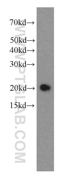 STMN3 Mouse anti-Human, Clone: 1F12B1, Proteintech 150 &mu;L; Unconjugated:Antibodies,