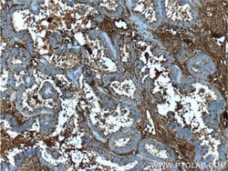 Ceruloplasmin Mouse anti-Human, Rat, Clone: 3C8A5, Proteintech:Antibodies:Primary