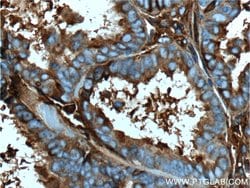 Ceruloplasmin Mouse anti-Human, Rat, Clone: 3C8A5, Proteintech:Antibodies:Primary