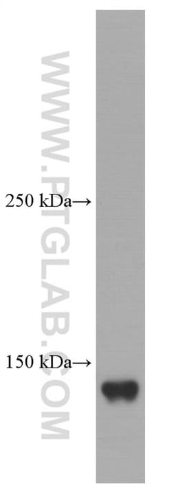 Ceruloplasmin Mouse anti-Human, Rat, Clone: 3C8A5, Proteintech:Antibodies:Primary