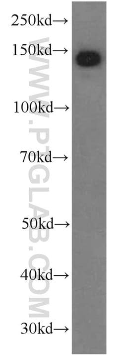 Ceruloplasmin Mouse anti-Human, Rat, Clone: 3C8A5, Proteintech:Antibodies:Primary