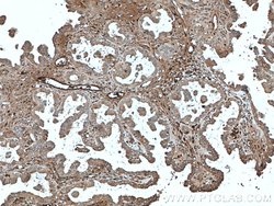 Ceruloplasmin Mouse anti-Human, Rat, Clone: 3C8A5, Proteintech:Antibodies:Primary