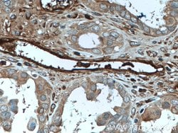 Ceruloplasmin Mouse anti-Human, Rat, Clone: 3C8A5, Proteintech:Antibodies:Primary