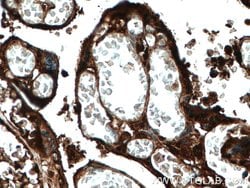 Ceruloplasmin Mouse anti-Human, Rat, Clone: 3C8A5, Proteintech:Antibodies:Primary