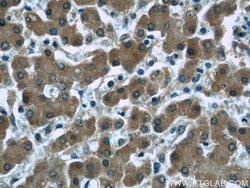 Ceruloplasmin Mouse anti-Human, Rat, Clone: 3C8A5, Proteintech:Antibodies:Primary